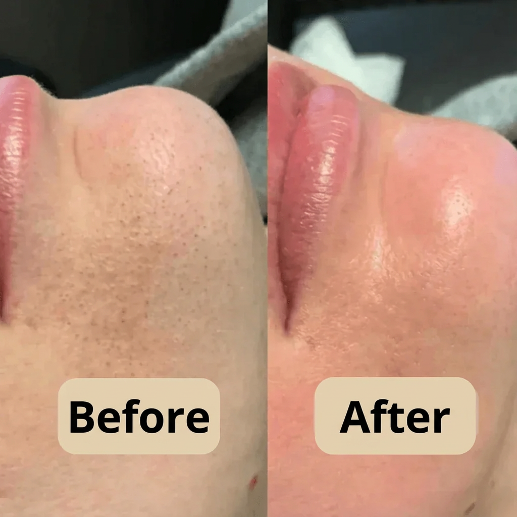 Korean Peel Shot – Removes Impurities & Enhances Your Skin