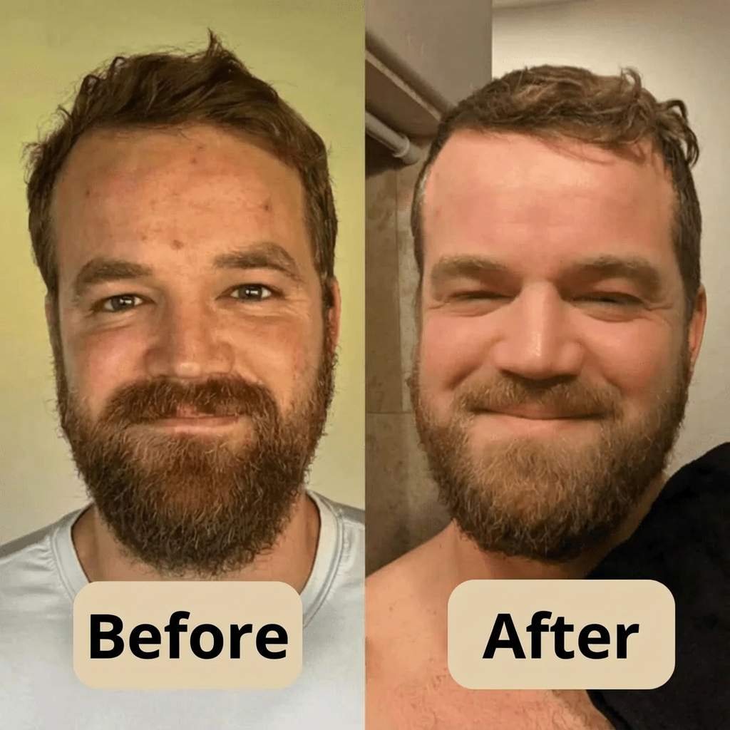 Korean Peel Shot – Removes Impurities & Enhances Your Skin