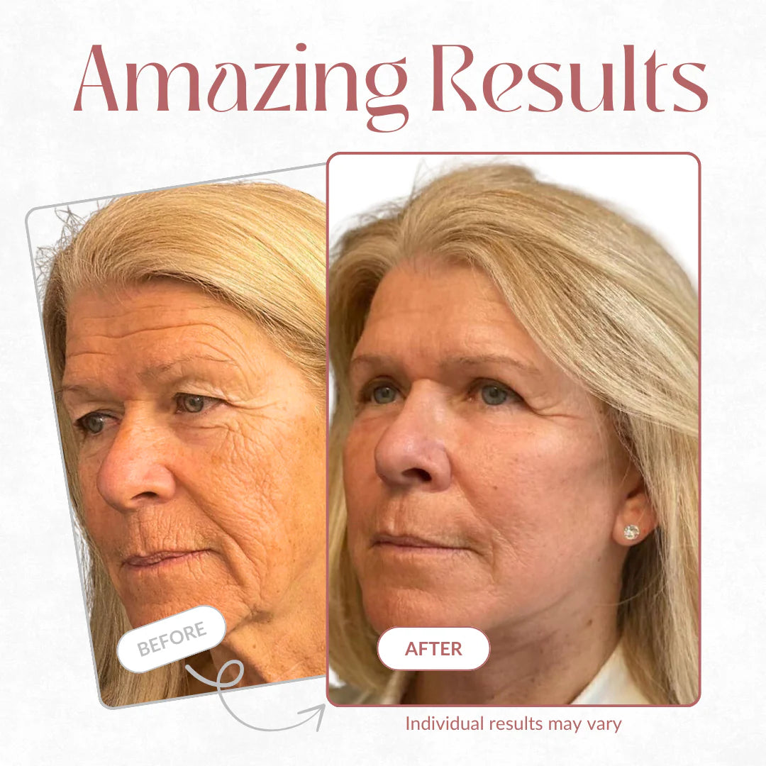 VELIA Calcium Volume Wrinkle-Core Multi Balm